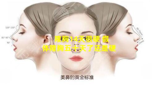 隆胸14天很硬 假体隆胸五十天了还是硬